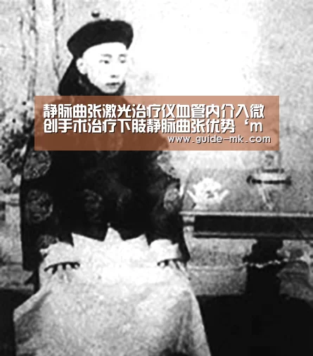 静脉曲张激光治疗仪血管内介入微创手术治疗下肢静脉曲张优势‘mk体育’(图3) mk体育官方网站