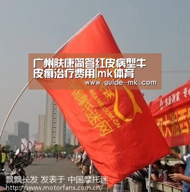 广州肤康简答红皮病型牛皮癣治疗费用|mk体育(图4) mk体育入口
