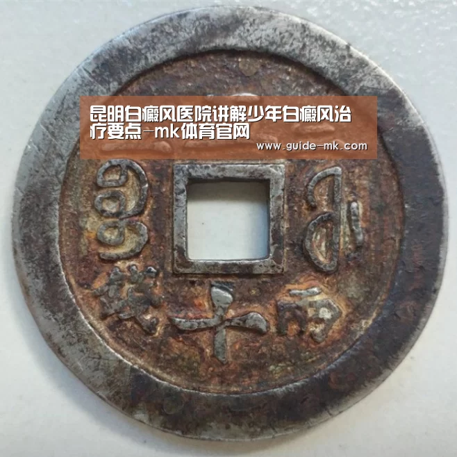 昆明白癜风医院讲解少年白癜风治疗要点-mk体育官网(图2) mk体育官方网站